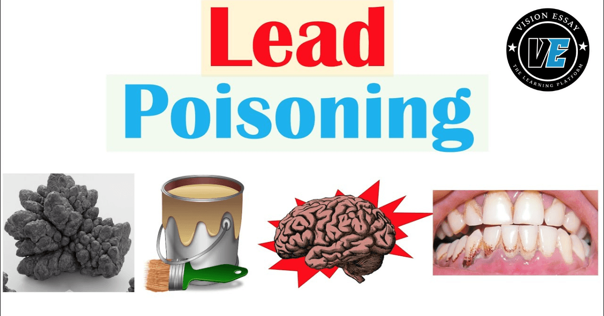 What is Lead Poisoning? 9 Lead Poisoning